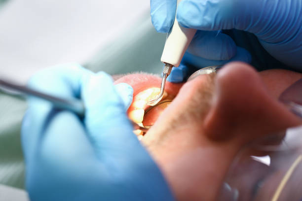 Best Tooth Infection Emergency Dentist  in Urbana, IL