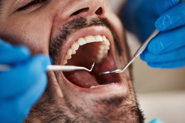 Best Root Canal Emergency Dentist  in Urbana, IL